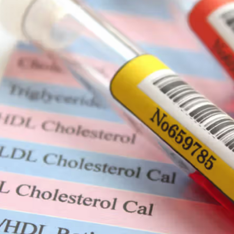cholesterol test results